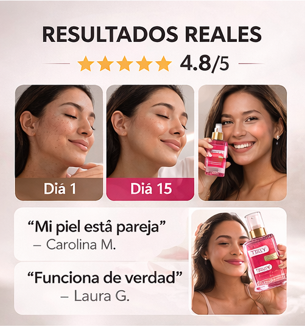SERUM DESPIGMENTANTE SMOOTH LEGEND / Despídete de las manchas. Reencuéntrate con tu mejor piel.